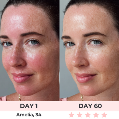 HeyWell™ - LED Face Mask